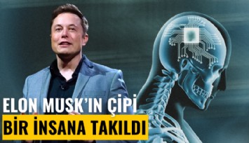 Elon Musk'ın çipi bir insana takıldı