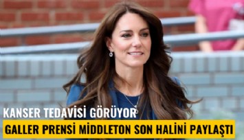 Kanser tedavisi görüyor: Galler Prensi Middleton son halini paylaştı