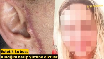 Estetik kabus: Kulağını kesip yüzüne diktiler