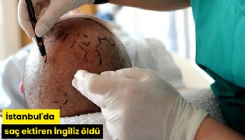 İstanbul'da saç ektiren İngiliz öldü