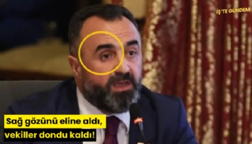 Sağ gözünü eline aldı, vekiller dondu kaldı!