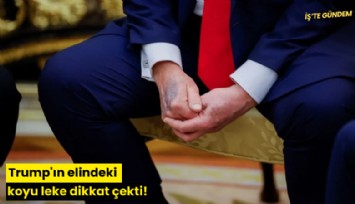 Trump'ın elindeki koyu leke dikkat çekti!