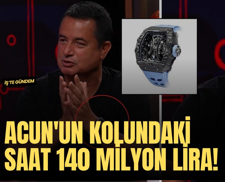 Acun'un kolundaki saat 140 milyon lira!